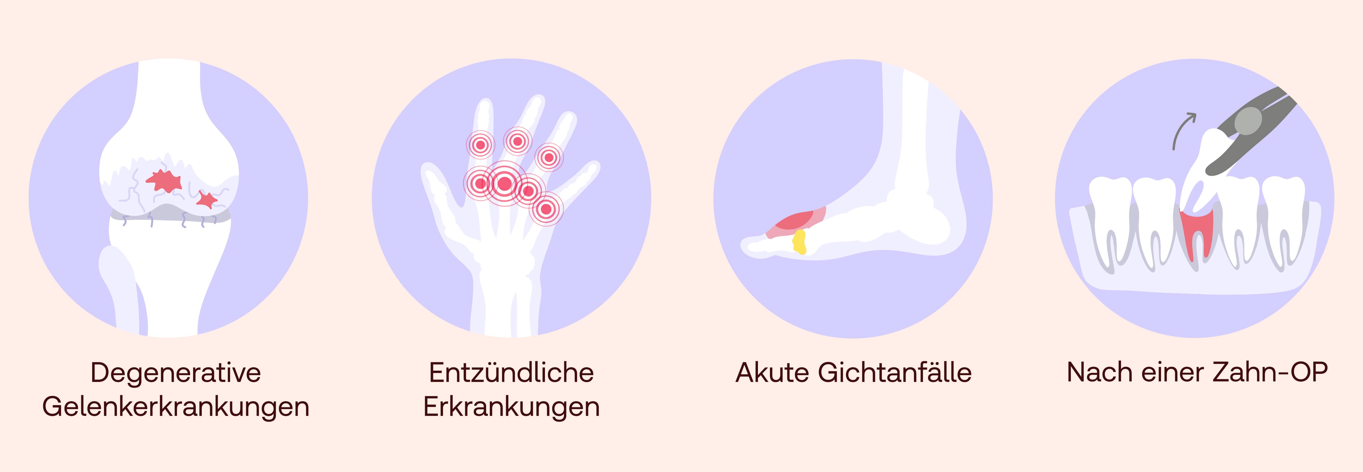 Etoricoxib Anwendungsbereiche