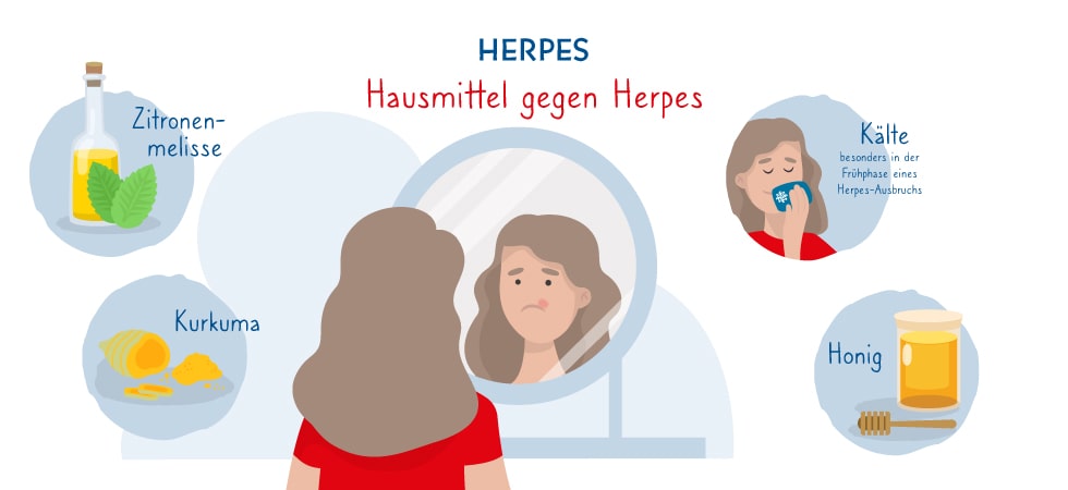 Hausmittel gegen Herpes