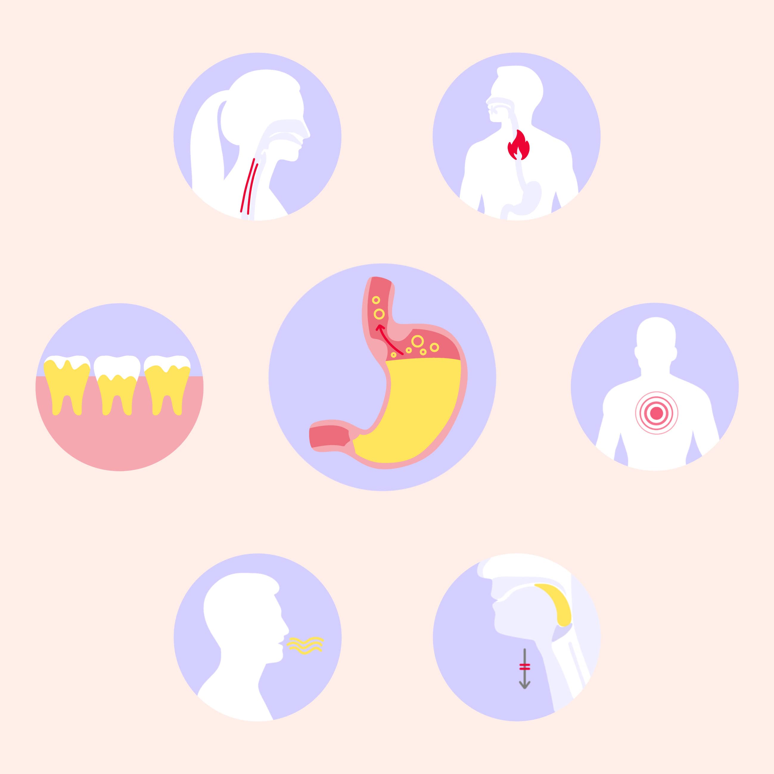 refluxkrankheit symptome