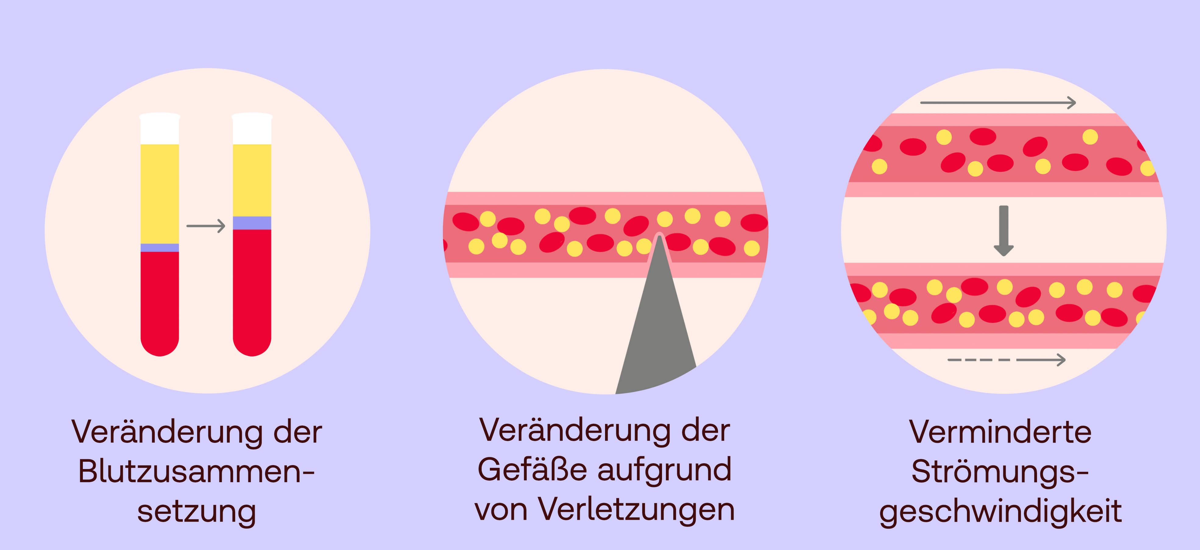 Thrombophlebitis ursache