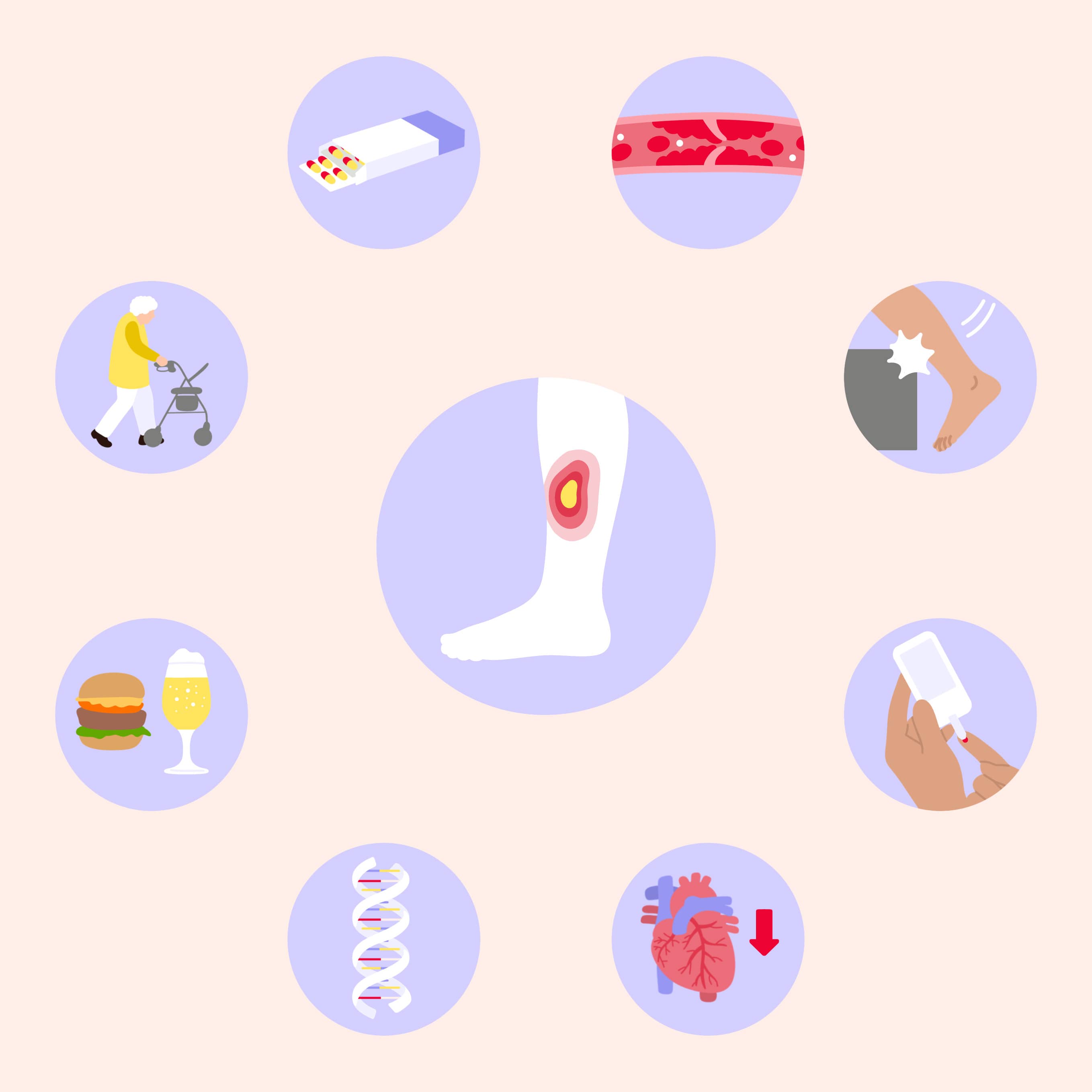 ulcus crusis ursache