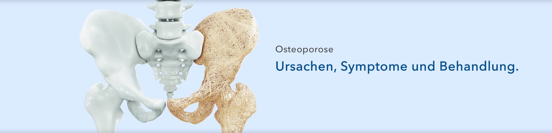 Osteoporose - Ursachen, Symptome und Behandlung