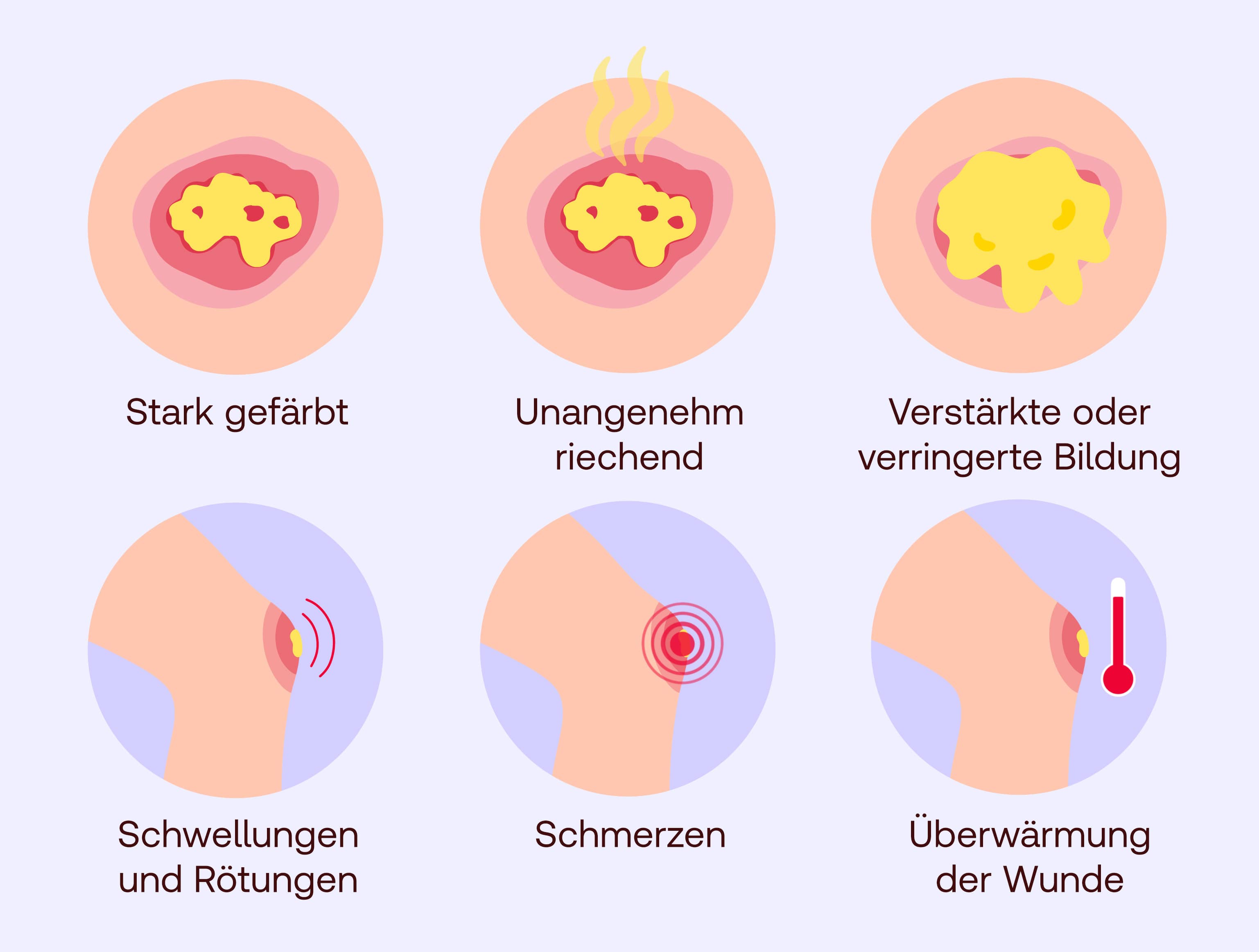 exsudat wann zum arzt