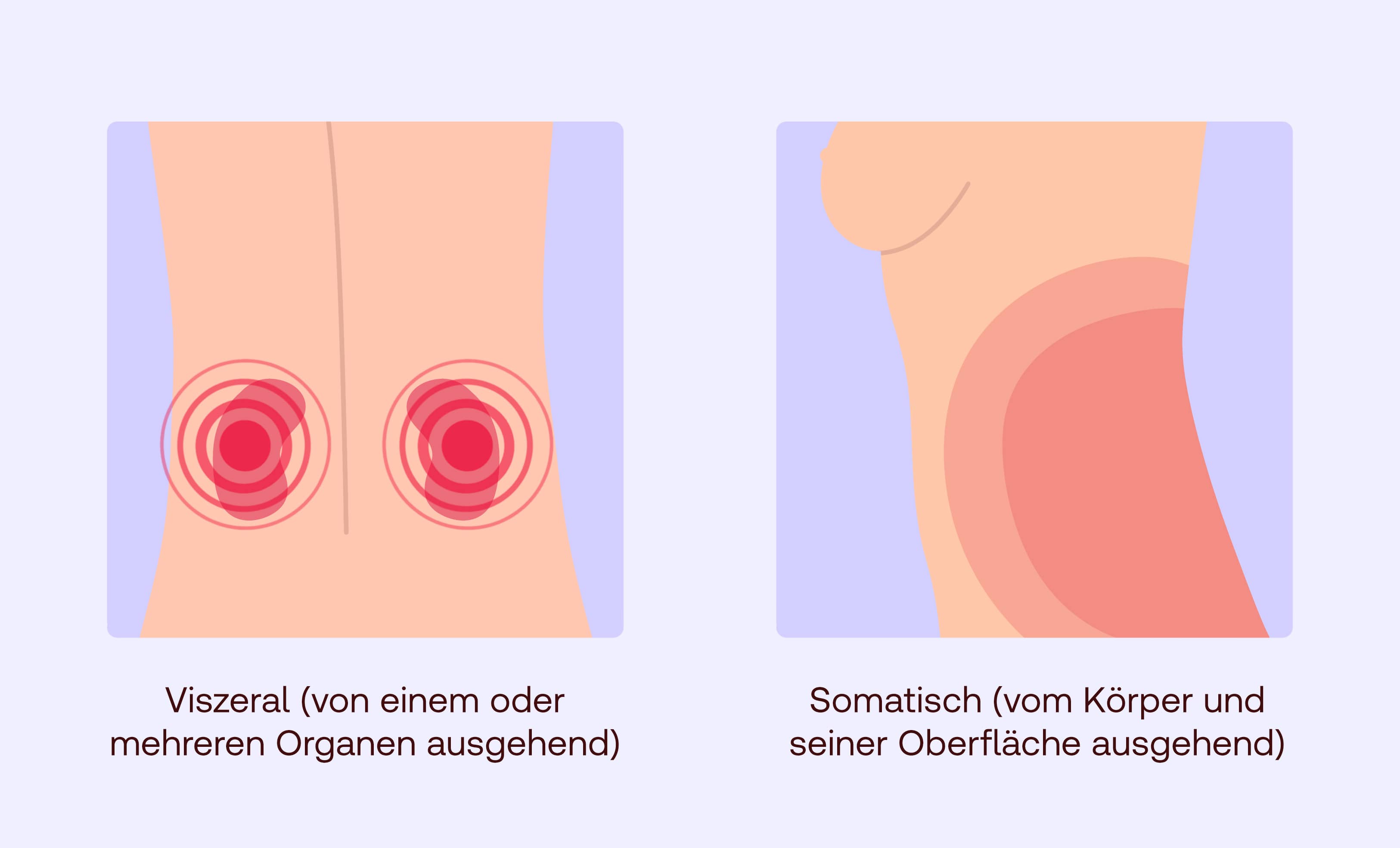 was sind flankenschmerzen