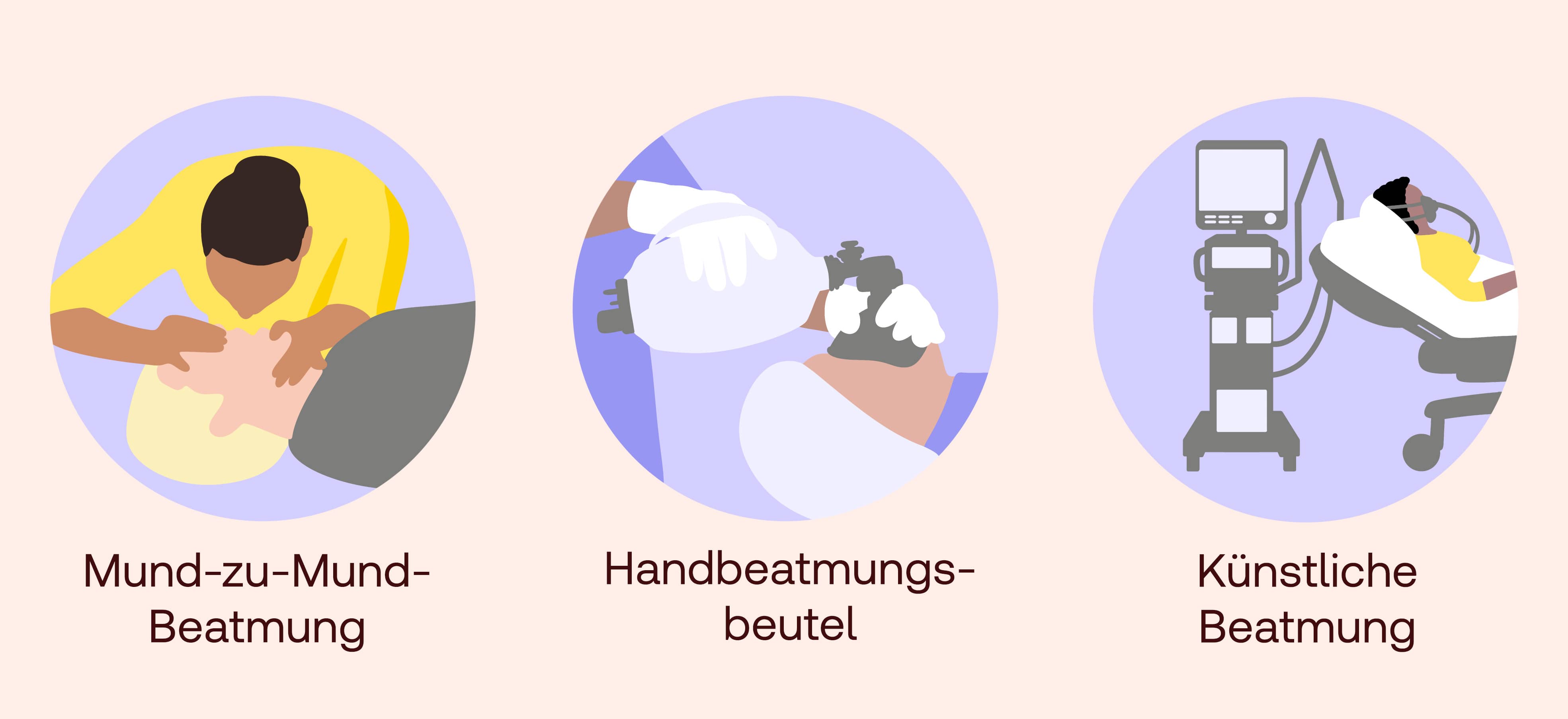 Beatmung Formen
