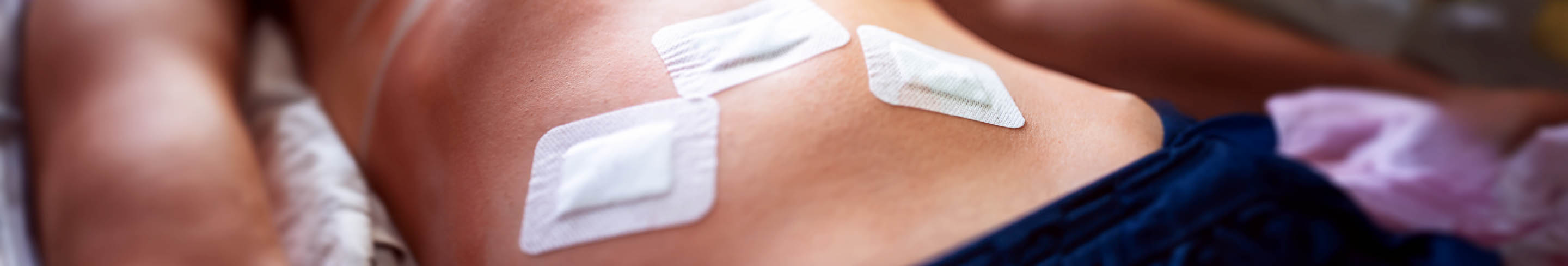 Ratgeber zu Debridement