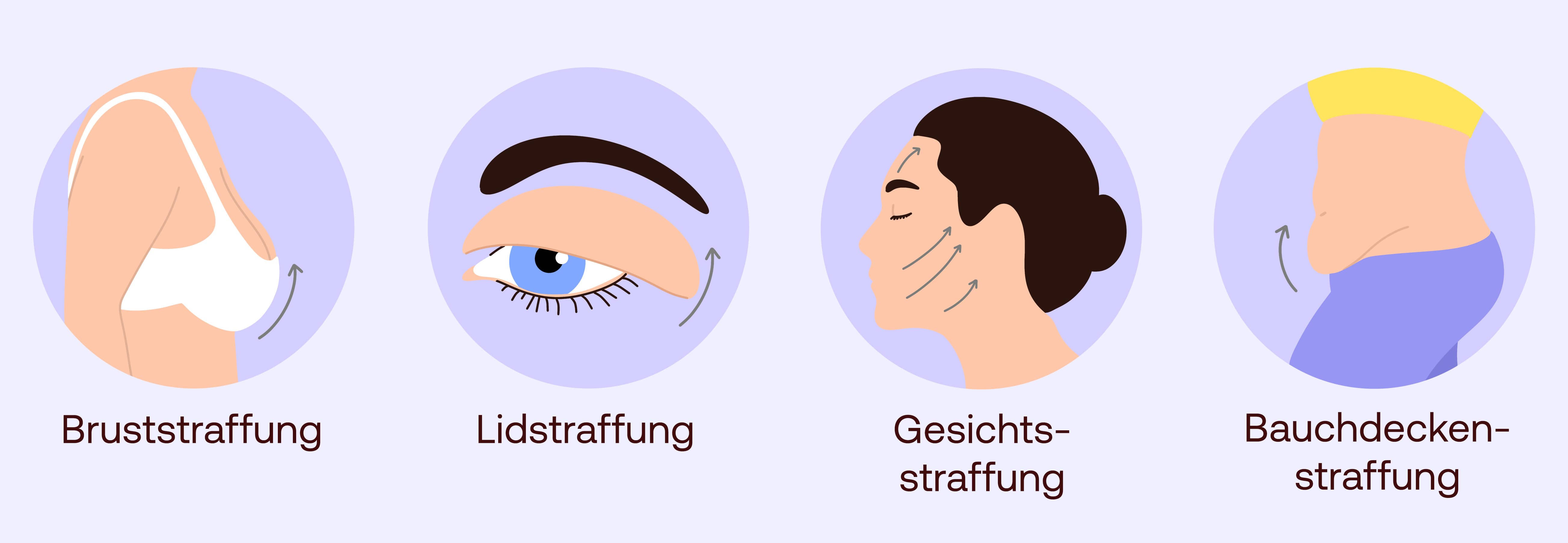 Hautstraffung Anwendungsgebiete