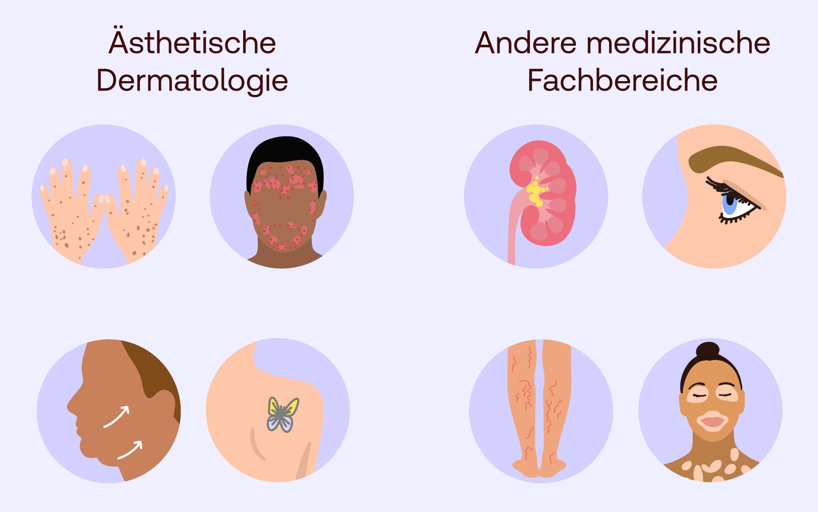Lasertherapie Anwndungsbereiche