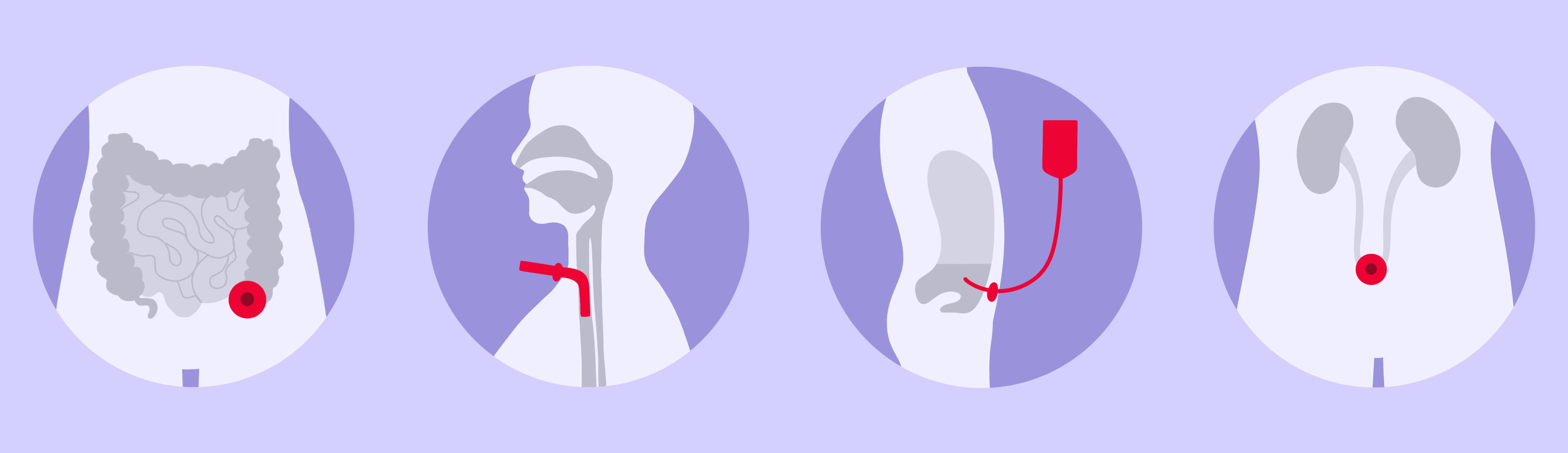 Stoma Behandlung & Wirkung Shop Apotheke