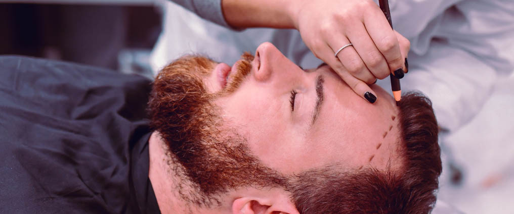 Haartransplantation für volleres Haar